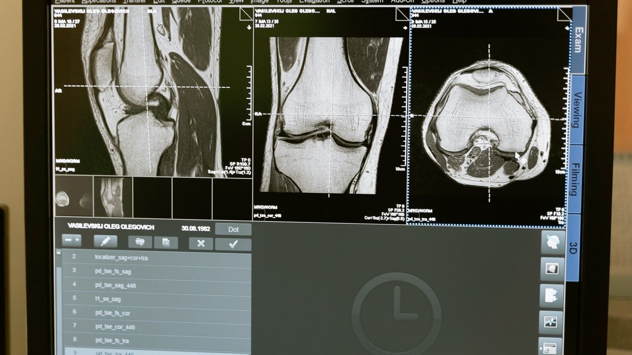 knee scan 2