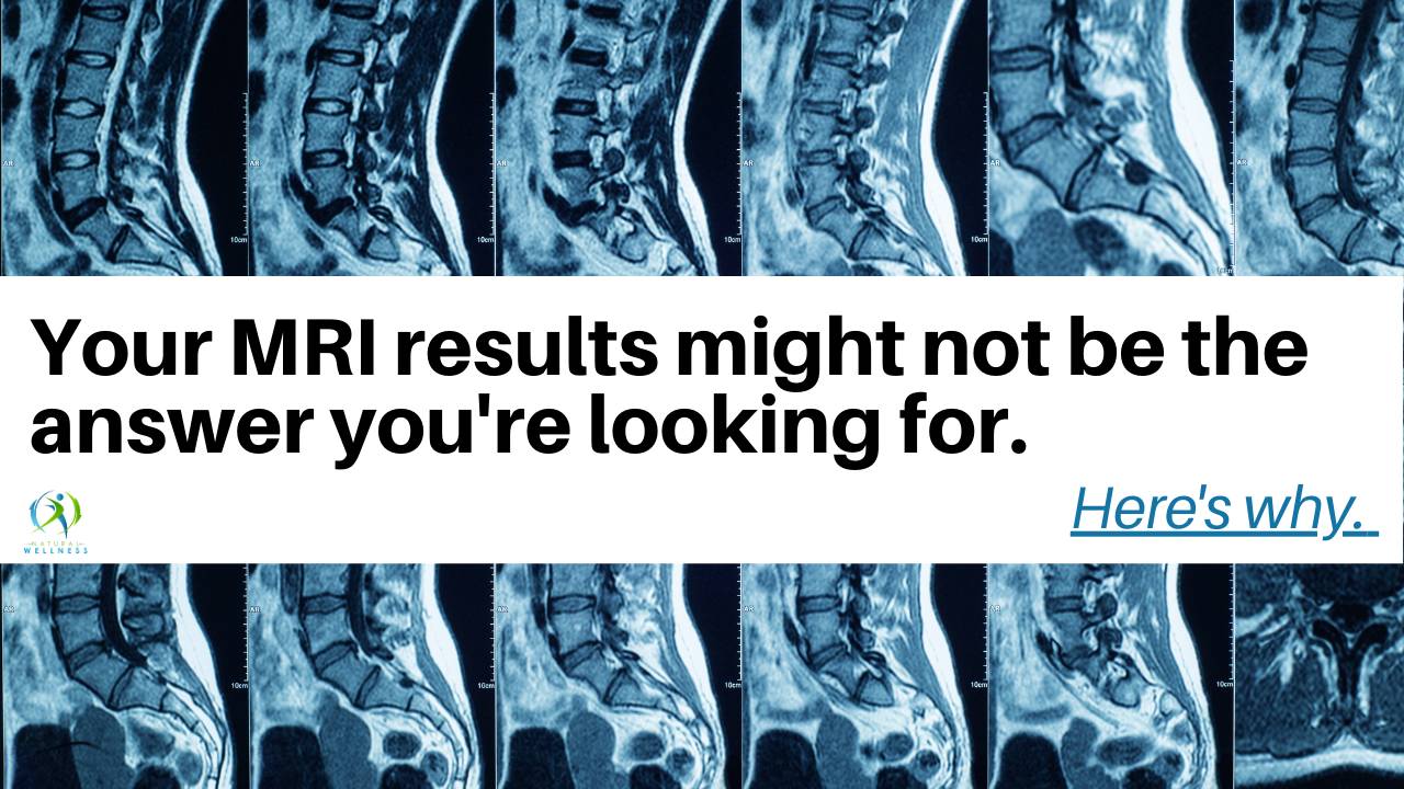 You are not your MRI: What shoulder scans after 40 really mean